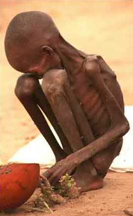 http://www.godlovespeople.com/starving_child-sudan2.jpg